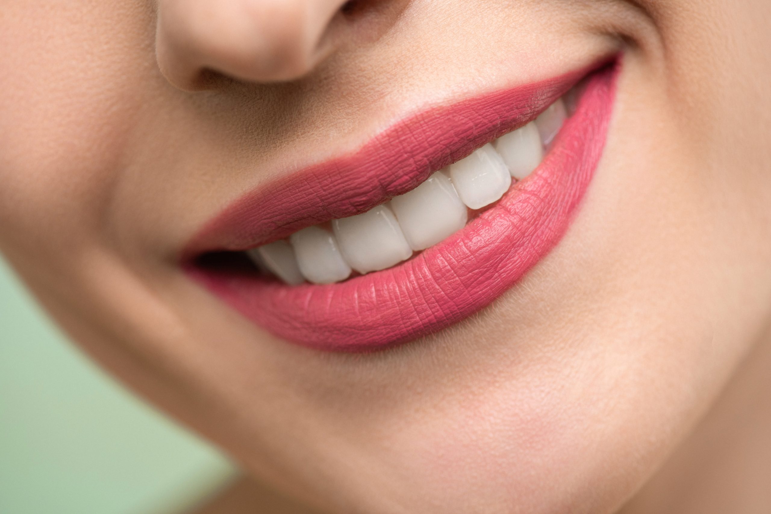 Is Teeth Whitening Covered by Insurance?